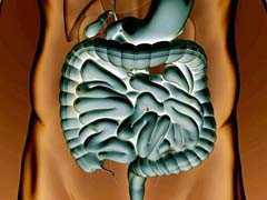 A Crohn-betegség és a microbiom
